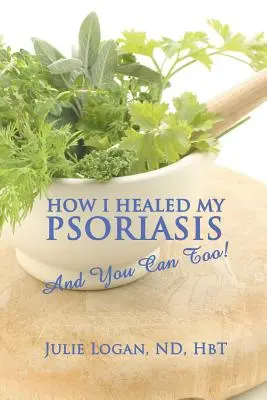 Come ho guarito la mia psoriasi: E potete farlo anche voi! - How I Healed My Psoriasis: And You Can Too!