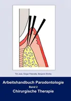 Arbeitshandbuch Parodontologie: Band 2 Terapia Chirurgica - Arbeitshandbuch Parodontologie: Band 2 Chirurgische Therapie