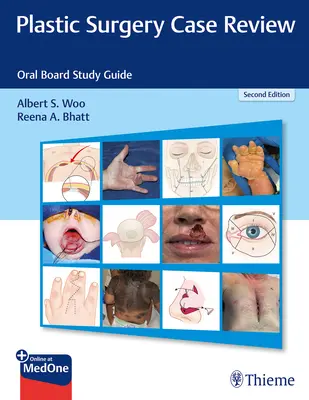 Rassegna di casi di chirurgia plastica: Guida allo studio della commissione orale - Plastic Surgery Case Review: Oral Board Study Guide