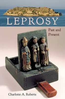 Lebbra: passato e presente - Leprosy: Past and Present