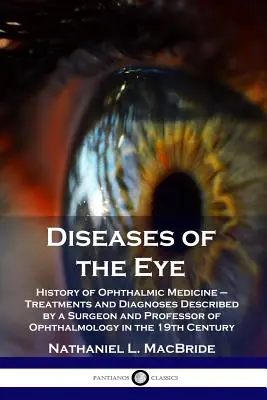 Malattie dell'occhio: Storia della medicina oftalmica - Trattamenti e diagnosi descritti da un chirurgo e professore di oftalmologia nel Regno Unito. - Diseases of the Eye: History of Ophthalmic Medicine - Treatments and Diagnoses Described by a Surgeon and Professor of Ophthalmology in the