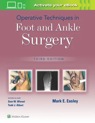 Tecniche operative nella chirurgia del piede e della caviglia - Operative Techniques in Foot and Ankle Surgery