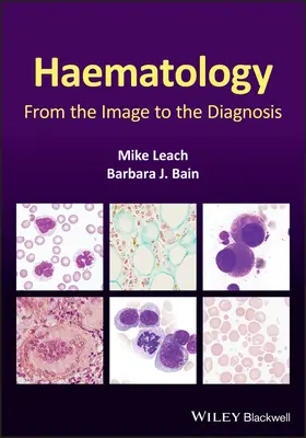 Ematologia: Dall'immagine alla diagnosi - Haematology: From the Image to the Diagnosis
