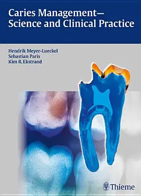Gestione della carie - Scienza e pratica clinica - Caries Management - Science and Clinical Practice