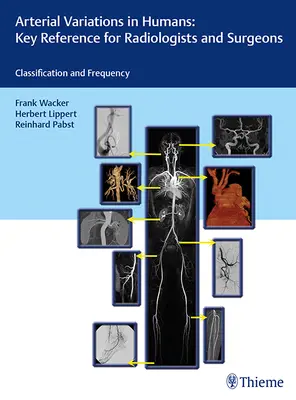 Variazioni arteriose nell'uomo: Riferimento chiave per radiologi e chirurghi: Classificazioni e frequenza - Arterial Variations in Humans: Key Reference for Radiologists and Surgeons: Classifications and Frequency