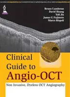 Guida clinica all'angio-OCT: Angiografia OCT non invasiva e senza coloranti - Clinical Guide to Angio-OCT: Non Invasive, Dyeless OCT Angiography