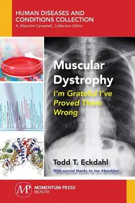Distrofia muscolare: Sono grato di aver dimostrato che si sbagliano - Muscular Dystrophy: I'm Grateful I've Proved Them Wrong