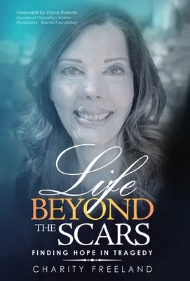La vita oltre le cicatrici: Trovare la speranza nella tragedia - Life Beyond the Scars: Finding Hope in Tragedy