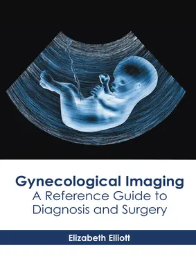 Imaging ginecologico: Guida di riferimento per la diagnosi e la chirurgia - Gynecological Imaging: A Reference Guide to Diagnosis and Surgery