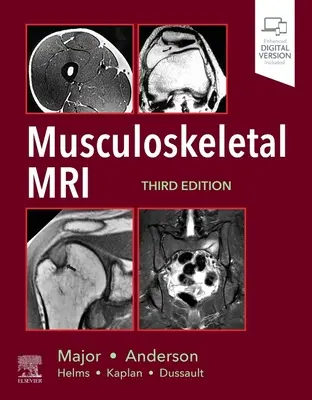Risonanza magnetica muscoloscheletrica - Musculoskeletal MRI