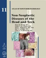 Malattie non neoplastiche della testa e del collo - Non-Neoplastic Diseases of the Head and Neck