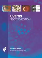 Uveite - Uveitis