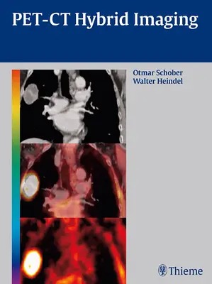 Imaging ibrido Pet-CT - Pet-CT Hybrid Imaging