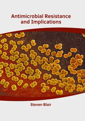 Resistenza antimicrobica e implicazioni - Antimicrobial Resistance and Implications