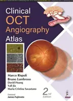 Atlante di angiografia OCT clinica - Clinical OCT Angiography Atlas