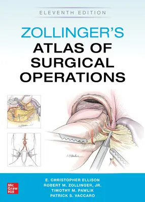 Atlante delle operazioni chirurgiche di Zollinger, undicesima edizione - Zollinger's Atlas of Surgical Operations, Eleventh Edition
