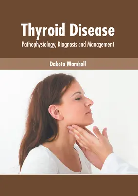 Malattie della tiroide: Fisiopatologia, diagnosi e gestione - Thyroid Disease: Pathophysiology, Diagnosis and Management