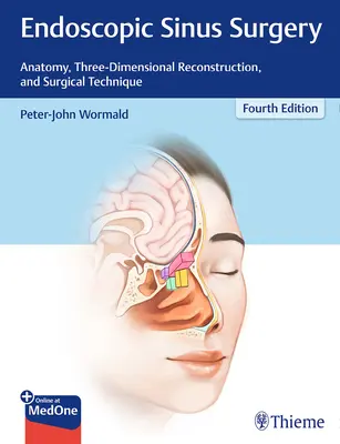 Chirurgia endoscopica dei seni paranasali: Anatomia, ricostruzione tridimensionale e tecnica chirurgica - Endoscopic Sinus Surgery: Anatomy, Three-Dimensional Reconstruction, and Surgical Technique