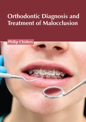 Diagnosi e trattamento ortodontico delle malocclusioni - Orthodontic Diagnosis and Treatment of Malocclusion