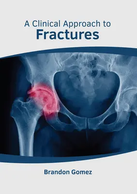 Un approccio clinico alle fratture - A Clinical Approach to Fractures
