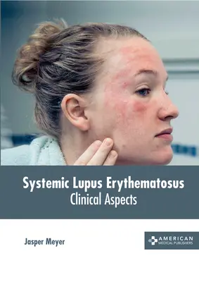 Lupus eritematoso sistemico: Aspetti clinici - Systemic Lupus Erythematosus: Clinical Aspects