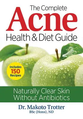 Guida completa alla salute e alla dieta per l'acne: Pelle naturalmente pulita senza antibiotici - The Complete Acne Health and Diet Guide: Naturally Clear Skin Without Antibiotics