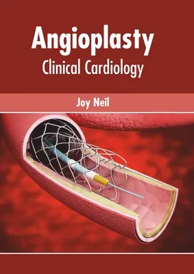 Angioplastica: Cardiologia clinica - Angioplasty: Clinical Cardiology