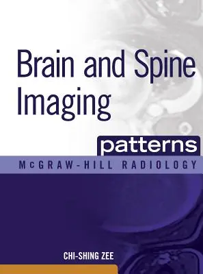 Modelli di imaging del cervello e della colonna vertebrale: Imaging del cervello e della colonna vertebrale - Brain and Spine Imaging Patterns: Brain & Spine Imaging