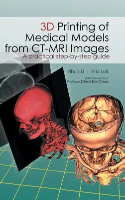 Stampa 3D di modelli medici da immagini CT-MRI: Una guida pratica passo-passo - 3D Printing of Medical Models from CT-MRI Images: A Practical step-by-step guide