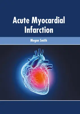 Infarto miocardico acuto - Acute Myocardial Infarction