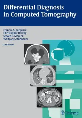 Diagnosi differenziale in tomografia computerizzata - Differential Diagnosis in Computed Tomography