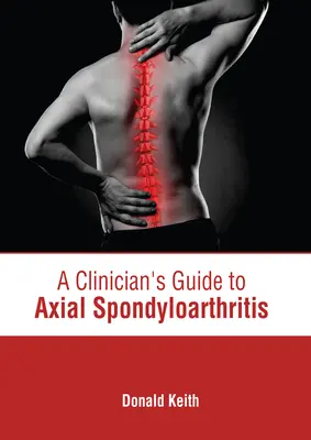 Guida del medico alla spondiloartrite assiale - A Clinician's Guide to Axial Spondyloarthritis