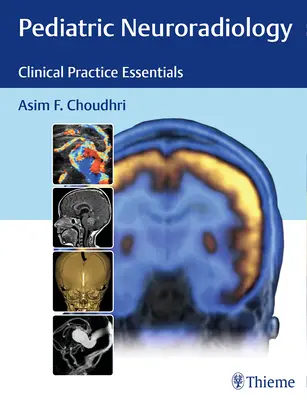 Neuroradiologia pediatrica: Elementi essenziali di pratica clinica - Pediatric Neuroradiology: Clinical Practice Essentials