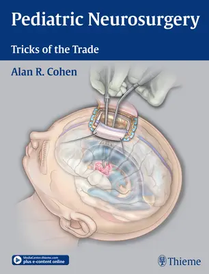 Neurochirurgia pediatrica: Trucchi del mestiere - Pediatric Neurosurgery: Tricks of the Trade