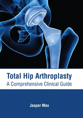 Artroplastica totale dell'anca: Guida clinica completa - Total Hip Arthroplasty: A Comprehensive Clinical Guide