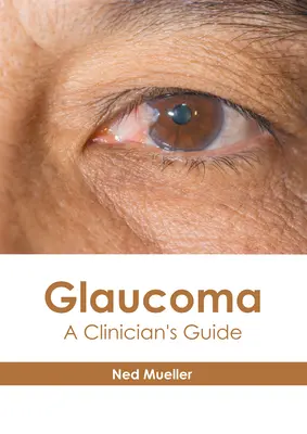 Glaucoma: Guida per il medico - Glaucoma: A Clinician's Guide