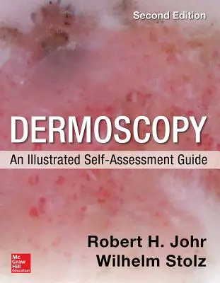 Dermoscopia: Guida illustrata all'autovalutazione, 2/E - Dermoscopy: An Illustrated Self-Assessment Guide, 2/E
