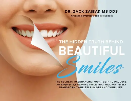 La verità nascosta dietro un bel sorriso: I segreti per migliorare i denti e ottenere un sorriso squisito e accattivante che trasformerà positivamente la vostra vita. - The Hidden Truth Behind Beautiful Smiles: The secrets to enhancing your teeth to produce an exquisite, engaging smile that will positively transform y