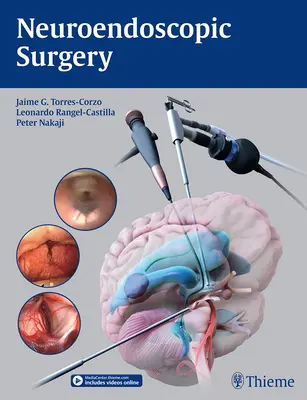 Chirurgia neuroendoscopica - Neuroendoscopic Surgery
