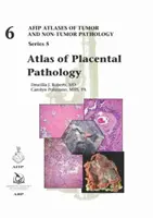 Atlante di patologia placentare - Atlas of Placental Pathology