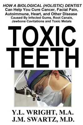 Denti tossici: Come un dentista biologico (olistico) può aiutarvi a curare il cancro, il dolore facciale, le malattie autoimmuni, il cuore e altre malattie causate - Toxic Teeth: How a Biological (Holistic) Dentist Can Help You Cure Cancer, Facial Pain, Autoimmune, Heart, and Other Disease Caused