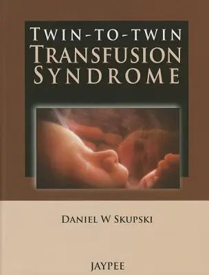 Sindrome da trasfusione da gemello a gemello - Twin-To-Twin Transfusion Syndrome