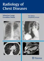 Radiologia delle malattie del torace - Radiology of Chest Diseases