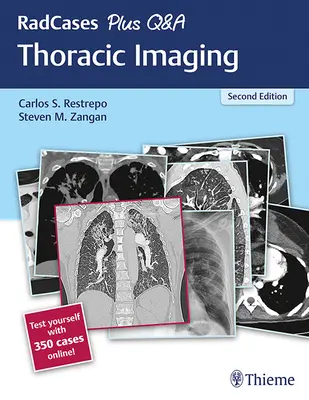 Radcases Plus Q&A Imaging Toracico - Radcases Plus Q&A Thoracic Imaging