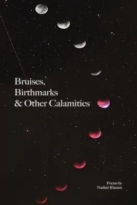 Lividi, voglie e altre calamità - Bruises, Birthmarks & Other Calamities