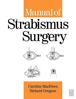 Manuale di chirurgia dello strabismo - Manual of Strabismus Surgery