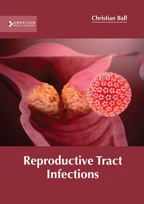 Infezioni del tratto riproduttivo - Reproductive Tract Infections