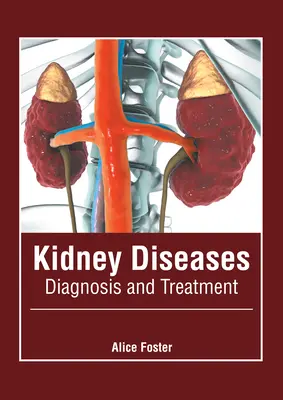 Malattie renali: Diagnosi e trattamento - Kidney Diseases: Diagnosis and Treatment