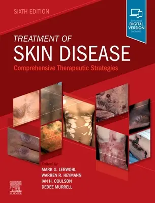 Trattamento delle malattie della pelle: Strategie terapeutiche complete - Treatment of Skin Disease: Comprehensive Therapeutic Strategies
