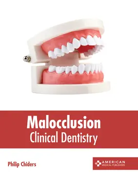 Malocclusione: Odontoiatria clinica - Malocclusion: Clinical Dentistry